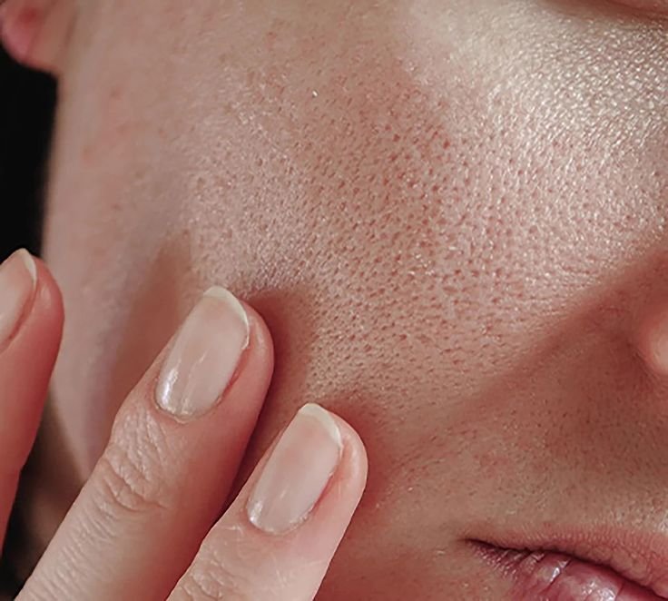 Perfect Pores: Your Guide to a Smoother, Clearer Complexion