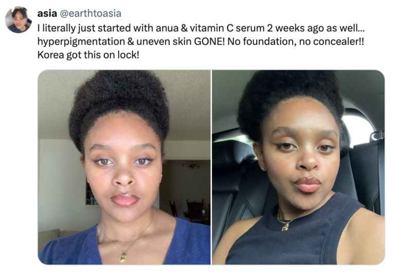 14 Days to Radiant Skin This Korean Skincare Routine Transformed Her